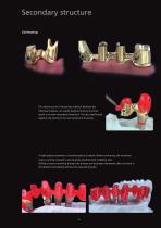 Gold-Standard for Implant Superstructures-10