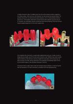 Gold-Standard for Implant Superstructures-11
