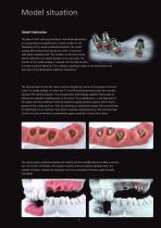 Gold-Standard for Implant Superstructures-4