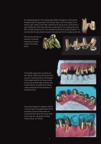 Gold-Standard for Implant Superstructures-9