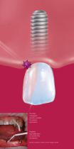 Implant Care - 15