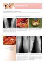 PORESORB ® -TC P-6