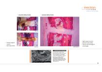 PIEZOSURGERY® touch-3