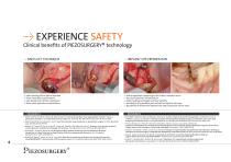 PIEZOSURGERY® touch-4