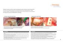 PIEZOSURGERY® touch-5