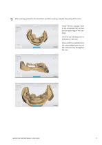 USER GUIDE FOR 3SHAPE MEDENTIWINGS-11