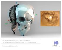 3D Accuitomo Clinical Case Evidence - 1