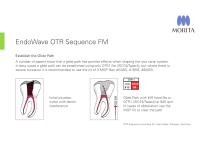 EndoWave OTR Sequence FM - 1