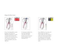 EndoWave OTR Sequence FM - 2