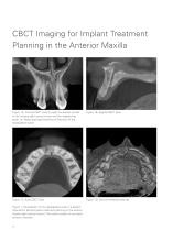 Implant Dentistry - 10