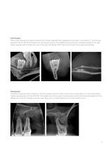 Veraviewepocs 3D R100 - 13