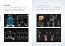 ProXIma X6 | MyRay-9