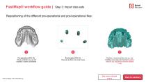 All-on-4® digital workflow-10