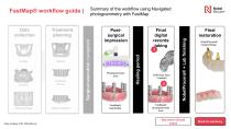 All-on-4® digital workflow-3
