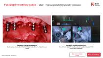 All-on-4® digital workflow-4