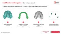 All-on-4® digital workflow-9