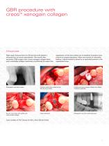 creos xenograft brochure-9