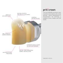 priticrown-3
