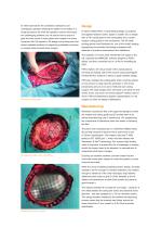 Digital evolution of cranial surgery - 2