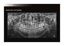 DENTIOIII - 6