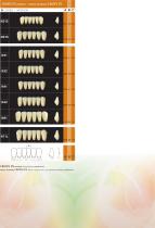 Mould Chart - 2