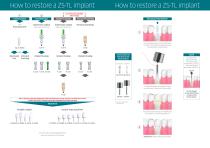 HOW TO RESTORE A Z5-TL IMPLANT - 2