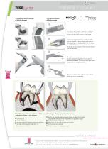 EXLOG RoBa Edition Extracting Forceps - 4