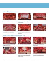 Endobon Xenograft Brochure - 3