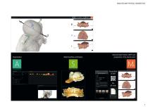 Brochure from scan to splint – 100% digital-7