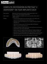 Case gallery Prettau® 2 Dispersive®-2