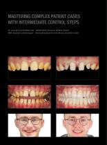 Case gallery Prettau® 3 Dispersive®-3