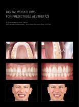 Case gallery Prettau® 3 Dispersive®-3