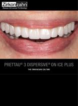 Case gallery Prettau® 3 Dispersive® on ICE Plus