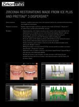 Case gallery Prettau® 3 Dispersive® on ICE Plus-2