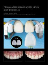 Case gallery Prettau® Skin® -3