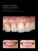 Case gallery Prettau® Skin®-3