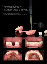 Insert Flexmon® Partials-3