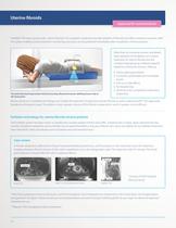 ExAblate OR Brochure for outside USA-10