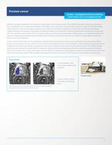 ExAblate OR Brochure for outside USA-7