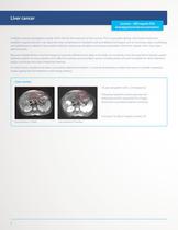 ExAblate OR Brochure for outside USA-8