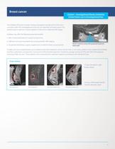 ExAblate OR Brochure for outside USA-9