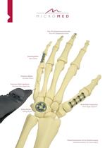 Hand Surgery-2