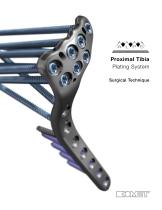 A.L.P.S.® Proximal Tibia Plating System