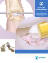 DeNovo® NT Natural Tissue Graft Arthroscopically-Assisted Surgical Technique for Ankle Cartilage Repair - 1