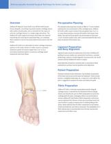 DeNovo® NT Natural Tissue Graft Arthroscopically-Assisted Surgical Technique for Ankle Cartilage Repair - 2