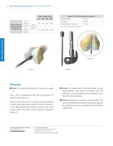 Distal Femoral Replacement-10