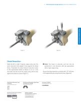 Distal Femoral Replacement-13