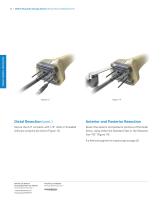 Distal Femoral Replacement-16
