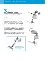 Explant Acetabular Cup Removal System Surgical Technique - 6