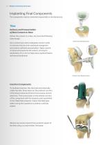 modern-cementing-technique - 6